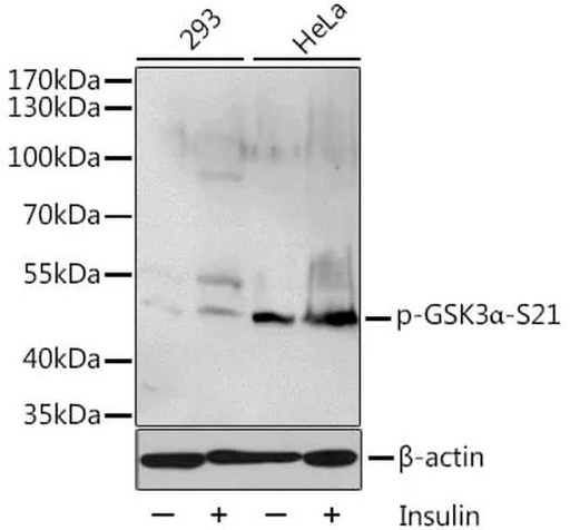 Antibodie to-GSK3A (phospho S21) 