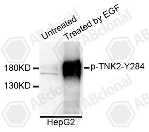 Antibodie to-TNK2 (phospho Y284) 