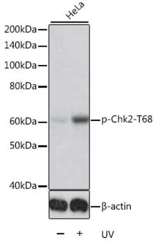 Antibodie to-CHEK2 (phospho T68) 