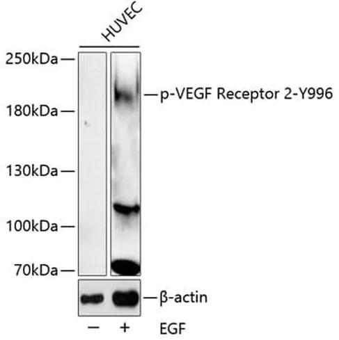 Antibodie to-VEGFR2 (phospho Y996) 