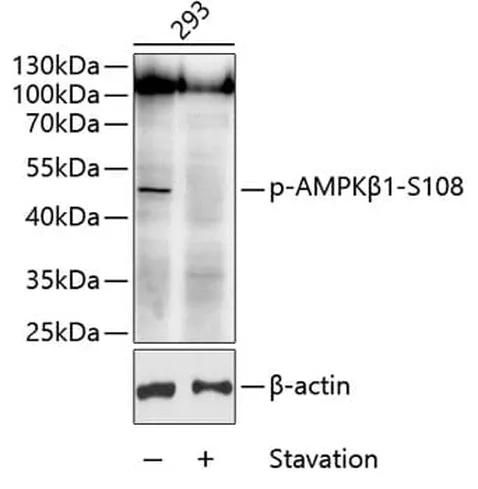 Antibodie to-AMPKß1 (phospho S108) 