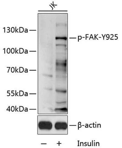 Antibodie to-PTK2 (phospho Y925) 