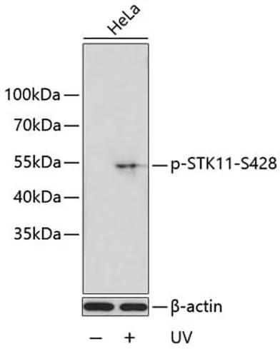 Antibodie to-STK11 (phospho S428) 