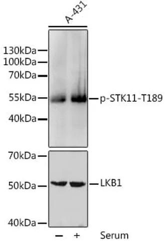 Antibodie to-STK11 (phospho T189) 