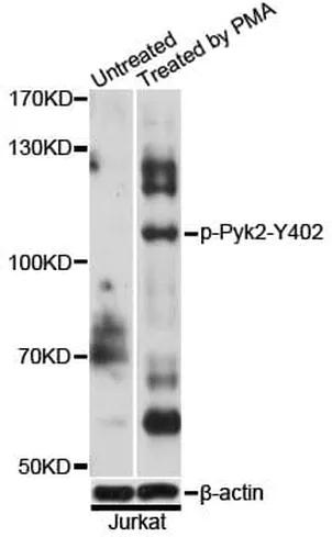 Antibodie to-Pyk2 (phospho Y402) 