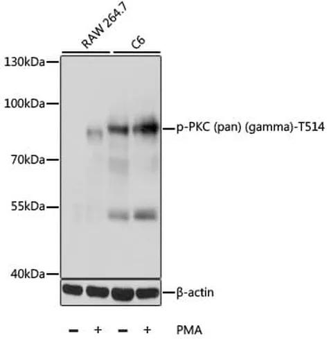 Antibodie to-PKC gamma (pan) (phospho T514) 