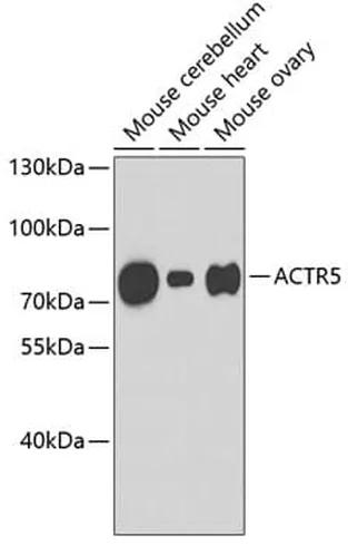 Antibodie to-ACTR5 