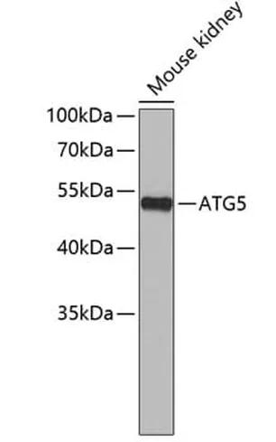 Antibodie to-EGR1 
