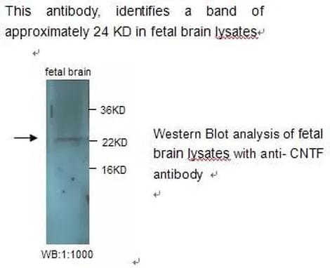 Antibodie to-CNTF 