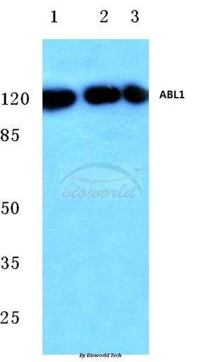 Antibodie to-ABL1 (E883) 