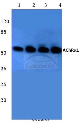 Antibodie to-AChRalfa1 (E217) 