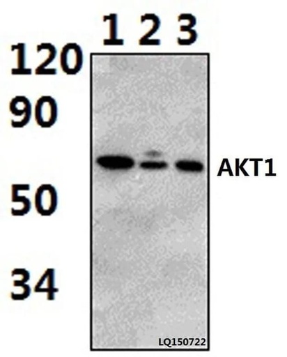 Antibodie to-AKT1 (P125) 