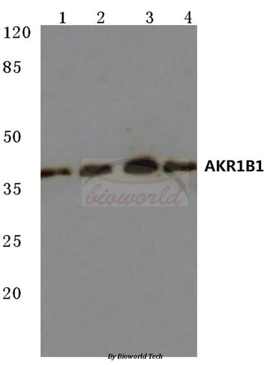 Antibodie to-AKR1B1 (K275) 