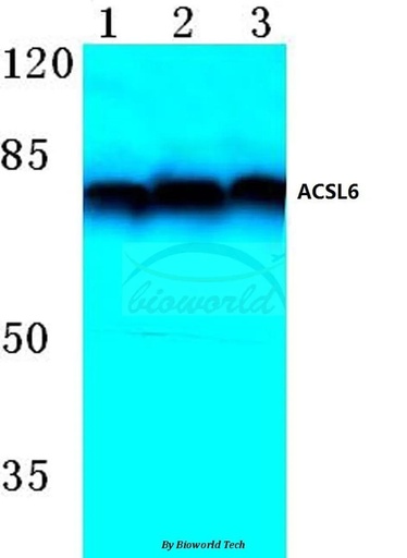 Antibodie to-ACSL6 (D531) 