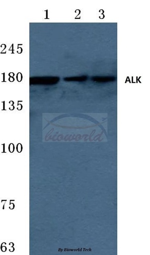 Antibodie to-ALK (W1503) 