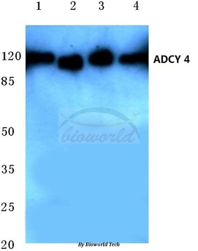 Antibodie to-ADCY 4 (L226) 