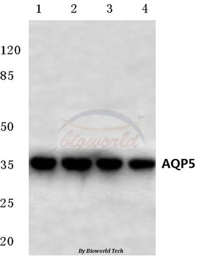 Antibodie to-AQP5 (Y243) 