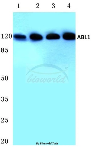 Antibodie to-ABL1 (L406) 