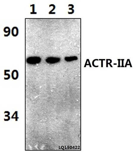 Antibodie to-ACTR-IIA (H59) 