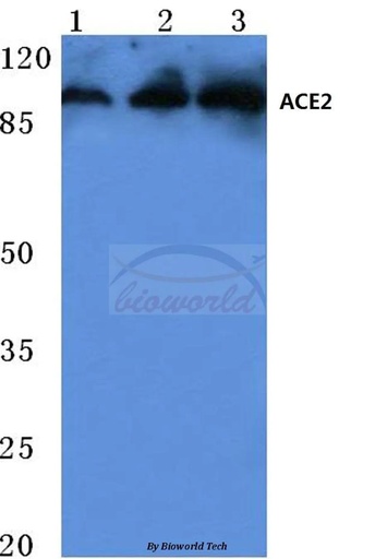 Antibodie to-ACE2 (K465) 