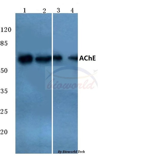 Antibodie to-AChE (K585) 