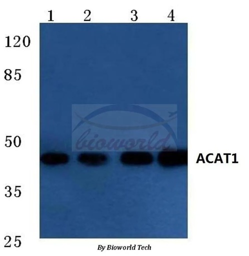 Antibodie to-ACAT1 (K266) 