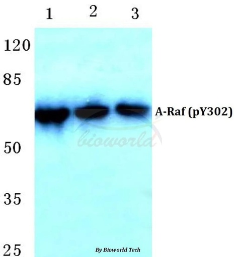 Antibodie to-A-Raf (phospho-Y302) 