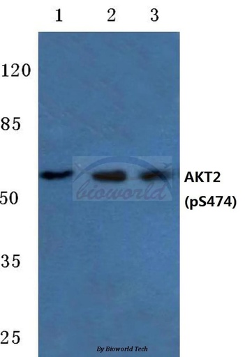 Antibodie to-AKT2 (phospho-S474) 