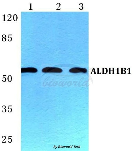 Antibodie to-ALDH1B1 