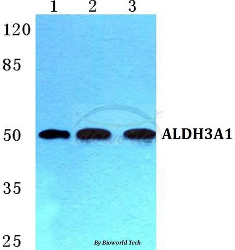 Antibodie to-ALDH3A1 