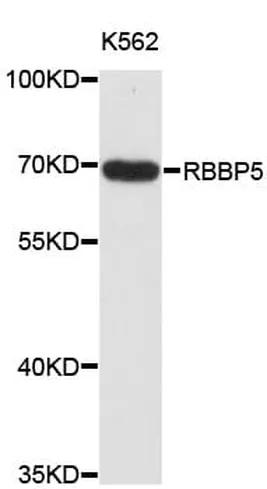 Antibodie to-S100A6 