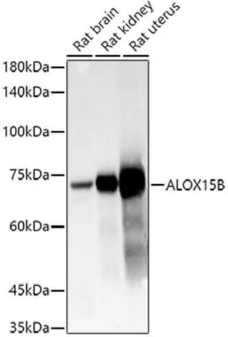 Antibodie to-ALPPL2 