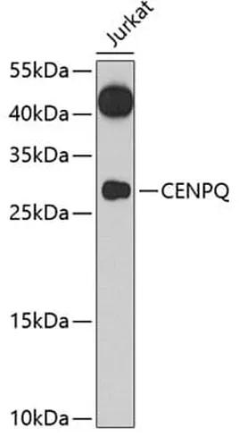 Antibodie to-ERp57 