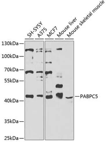 Antibodie to-ABL1 (phospho Y245) 