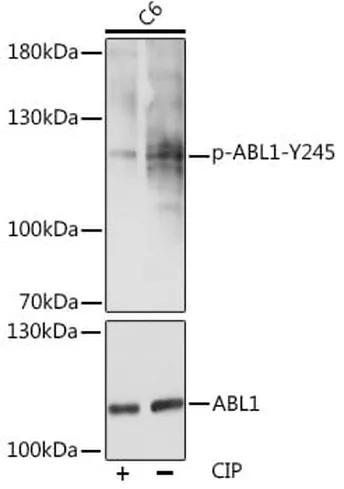 Antibodie to-ABL1 (phospho Y204) 