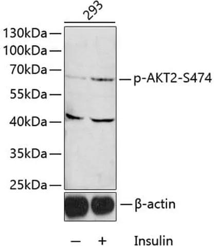 Antibodie to-CHEK1 (phospho S280) 