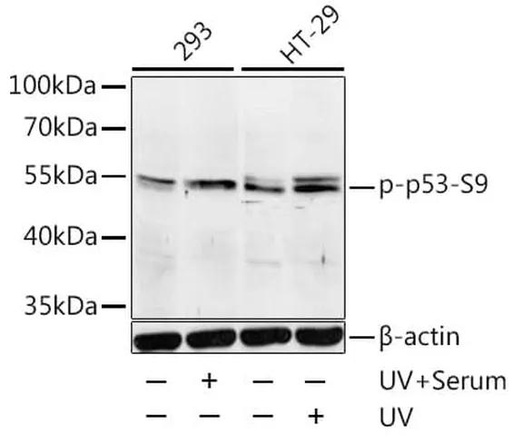 Antibodie to-Bad (phospho S136) 