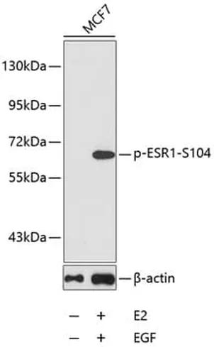 Antibodie to-ESR1 (phospho S118) 