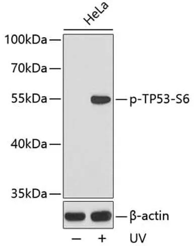 Antibodie to-FOXO1 (phospho S319) 