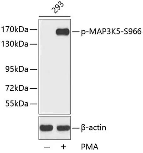 Antibodie to-SMC1A (phospho S957)  - Identical to Abcam (ab194759)