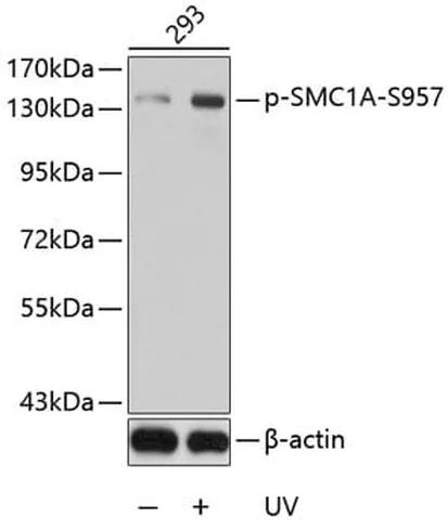 Antibodie to-BCR (phospho Y177)  - Identical to Abcam (ab194762)