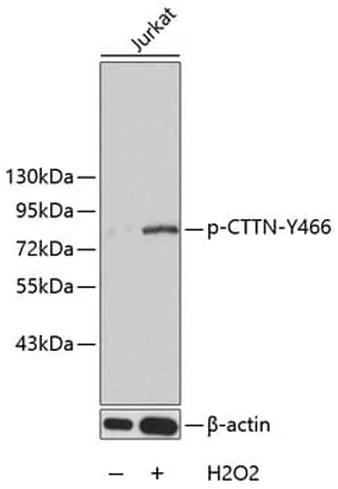 Antibodie to-ITGB3 (phospho Y785) 