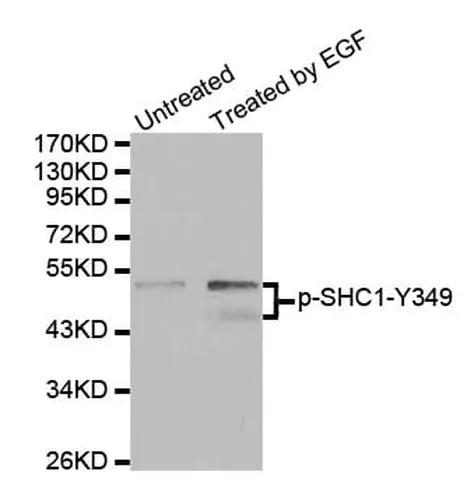 Antibodie to-CTNNA1 (phospho S641) 