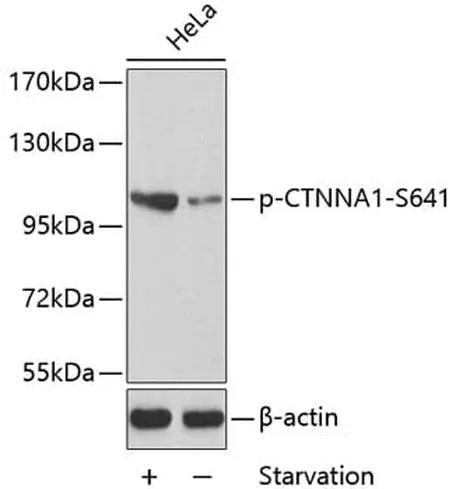 Antibodie to-EIF4B (phospho S422) 