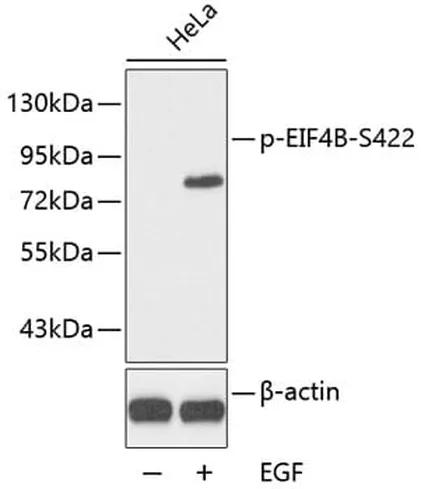 Antibodie to-ABL1 (phosphoY393) + ABL2 (phosphoY429) 