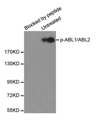 Antibodie to-KDR (phospho Y1059) 