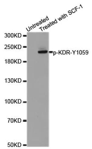 Antibodie to-Lck (phospho Y505) 