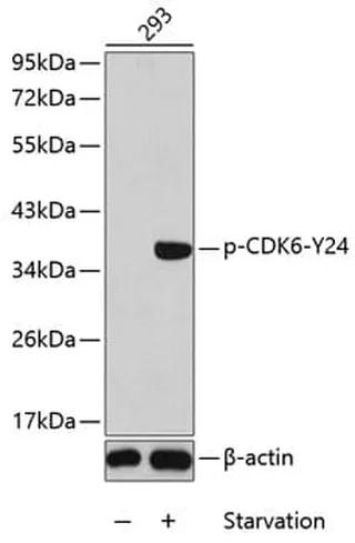 Antibodie to-ABL1 (phospho Y412)  - Identical to Abcam (ab194870)