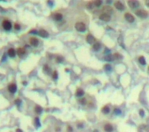 Antibodie to-CDK6 (phospho Y13) 