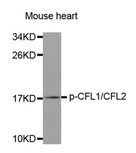 Antibodie to-EFNB2 (phospho Y316) 